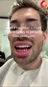 Man gets BUDGET teeth shaving in Turkey