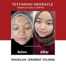 Contact miracle gemstones on messenger. Info Meeracle Gemstone Skincare Testimoni Kosmetik Cida