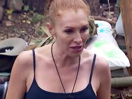 Georgina Fleur: Mit blauem Auge im Dschungelcamp? Das steckt dahinter