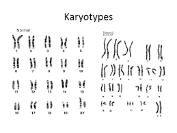 How can we use genetics to study human inheritance?chapter summary karyotypes 14.1 human transmission of human traits chromosomes human pedigrees from molecule to phenotype 14.2 human genetic disorders chromosomal disorders 14.3 studying the manipulating dna human genome the human genome project 1. 14 1 Human Chromosomes Key Questions 1 What Is A Karyotype 2 What Patterns Of Inheritance Do Human Traits Follow 3 How Can Pedigrees Be Used To Analyze Ppt Download