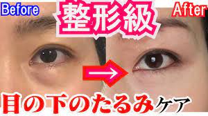 50 60代も1週間で激変 リバウンドしない目の下のたるみをとるマッサージ エクササイズ夜の美顔ヨガ youtube フェイスケア 顔のエクササイズ 目の下