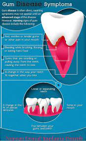 How To Find Gum Disease Symptoms Gum Disease Symptoms Disease Infographic Gum Disease
