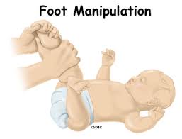 Thickening of the tendon sheaths frequently is present, especially of the tibialis posterior and peroneal sheaths. Patient Education Concord Orthopaedics