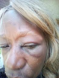 Throwing yourself infront of 14,000 pounds is not the brightest idea!😠😤  Missed him by a hair!!