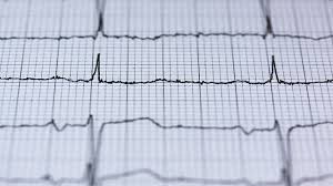 Common questions and answers about pacemaker cells function. Scientists Take Stem Cells And Convert Them To Heart Pacemaker Cells Technology Networks