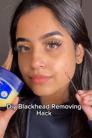 Patrick Stauffer (pdunit)