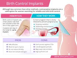 Speak to your dentist to learn more about how much a dental implant procedure will cost you. Birth Control Implant Shecares