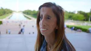 TeleProgreso Honduras