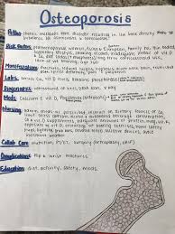 Osteoporosis Bones Joints Nursing Nursing School Nursing Student Education Nursing School Notes Nursing School Survival Medical School Studying