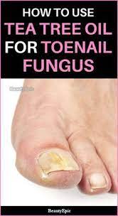 Tea Tree Oil To Treat Toenail Fungus How To Use Tea Tree Oil Benefits Toenail Fungus Nail Fungus Treatment
