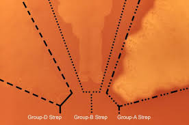 Image result for Group D Streptococcus