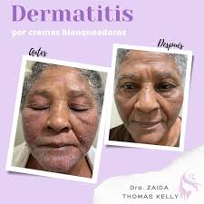 Dra. Zaida Thomas Kelly