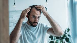 Was Hilft Gegen Haarausfall Mit Diesen Experten Tipps Sieht Ihr Haar Wieder Gut Aus Gq Germany