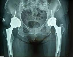 Use the mouse scroll wheel to move the images up and down alternatively use the tiny arrows (>>) on both side of the. 1 087 Pelvis Xray Photos Free Royalty Free Stock Photos From Dreamstime