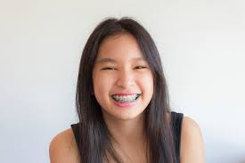 Old dominion orthodontics has not yet specified accepted insurance plans. How To Avoid Delays In Orthodontic Treatment