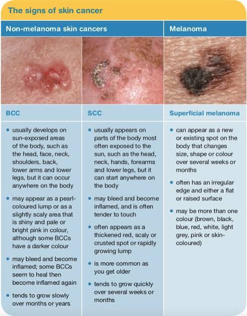 Skin cancer: the warning signs - myDr.com.au