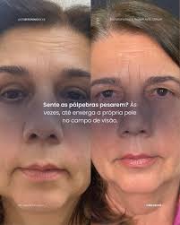 Qual desses mais te surpreendeu? Dr. Geronimo Silva