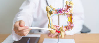 Image result for Colorectal Cancer