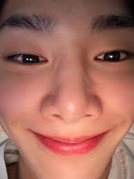 Recovering from brain surgeries with support