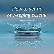 How to cure eczema on eyelids with herbal treatment? How To Get Rid Of Weeping Eczema