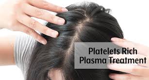 What is involved in a prp treatment? Best Hair Specialist In Hyderabad With Proven Results At Low Cost