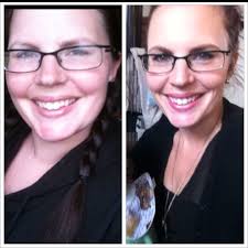 Pin On Before After Weight Loss Pics