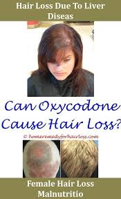 However, the dosage is actually different and varies. Hair Loss How Many Milligrams Of Biotin For Hair Loss Residue On Scalp And Hair Loss Jojoba Oil Fo Hair Loss Women Dermatologist Hair Loss Biotin For Hair Loss