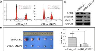 When chadwick boseman died from colon cancer, ibram x. Association Of Cn2 Expression With Colon Cancer Cell Cycle Progression Download Scientific Diagram