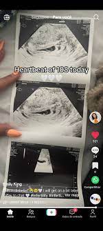 everything was okay with Emilys baby, so happy for her 🩷 : rpeestickgals