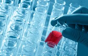 Plus besoin d'être à jeun ! Creatinine Comment S Y Preparer Fiches Sante Et Conseils Medicaux