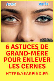 Les Cernes Sont Dus Au Manque De Sommeil A La Fatigue A L Age Aux Genes Stress Et A Bien D Autres Fact Enlever Les Cernes Comment Enlever Les Cernes Cernes