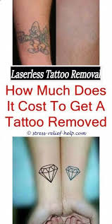 On extra large tattoos (tattoos over 15 cm sq), picosure laser. Tattoo Eraser Tattooeraser Profile Pinterest