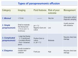 Image result for Parapneumonic Effusion