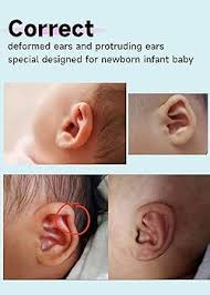 Amazon.com: Baby Ear Corrector, Infant Ear Tape for Babies ...