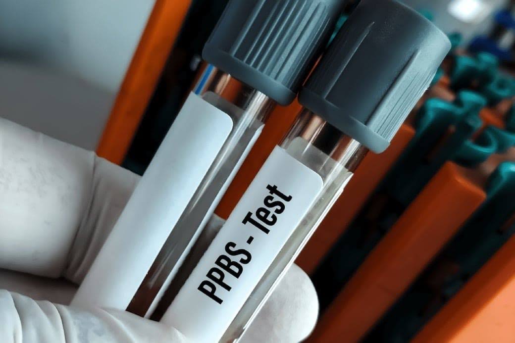 PPBS product image