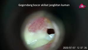 Tenaga medis yang dibutuhkan satu orang spesialis untuk. Cuci Telinga Di Klinik Kesihatan