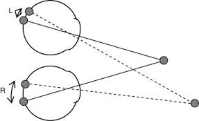 He is accepting new patients and has indicated that he accepts telehealth appointments. Stereo Vision And Strabismus Eye