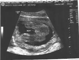 When the first day of pregnancy you will be offered a. Dating Scan At 8 Weeks