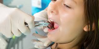 Although permanent teeth were meant to last a lifetime, there are a number of reasons why tooth extraction may be needed. Jackson Wisdom Teeth Extractions Dental Care Of Jackson Hole