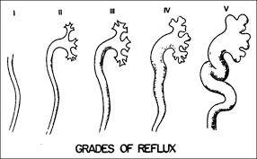 Figure 4 Urinary Tract Infections And Vesicoureteral Reflux In Infants And Children American Academy Of Pediatrics