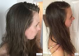 Thus, if you are looking for easing your trouble of itchy and irritated scalp, then use baking soda. Christine Goes No Poo The Barefoot Budget
