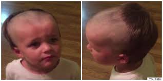 The low hairline is one of the prevalent types of hairline found among people. Boy Accidentally Gives Himself Receding Hairline Will Never Touch Daddy S Razor Again Huffpost Uk Parents