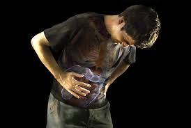 Image result for Constipation in Cancer