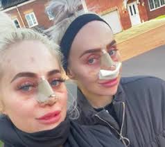 Gêmeas desembolsam mais de 1 milhão de reais em plásticas para ficarem  'iguaizinhas'