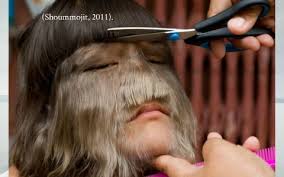 Werewolf syndrome is the popular name given to hypertrichosis. Hypertrichosis Werewolf Disorder By Lexie Wright