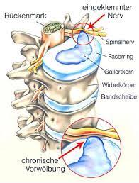 | du stellst dir vielleicht schon länger die frage was ist osteopathie oder was macht ein osteopath ? Osteopathie Alle Infos Die Wichtigsten Behandlungen Osteomedicum