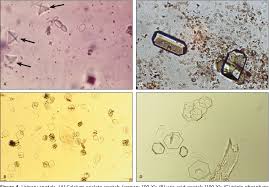 Figure 4 From Urinalysis A Comprehensive Review Semantic Scholar