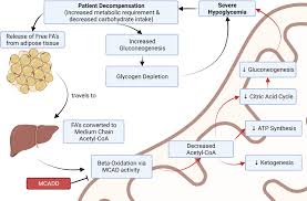 Image result for MCAD Deficiency