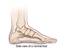 Charcot Foot Symptoms Causes Diagnosis Treatment Management