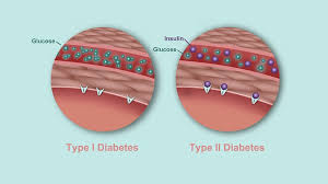 whats the difference between type 1 and type 2 diabetes